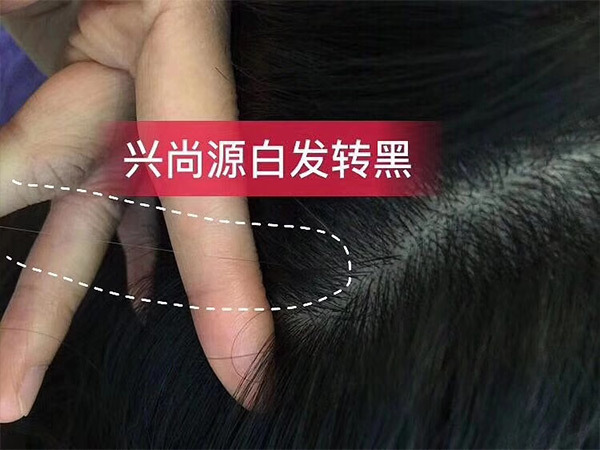 兴尚源白发转黑