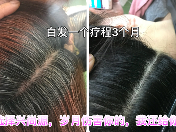 白发转黑发
