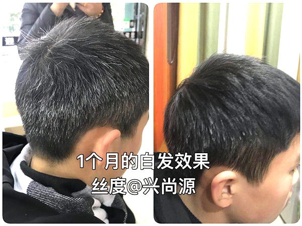 兴尚源头发白转黑