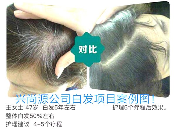白发转黑发