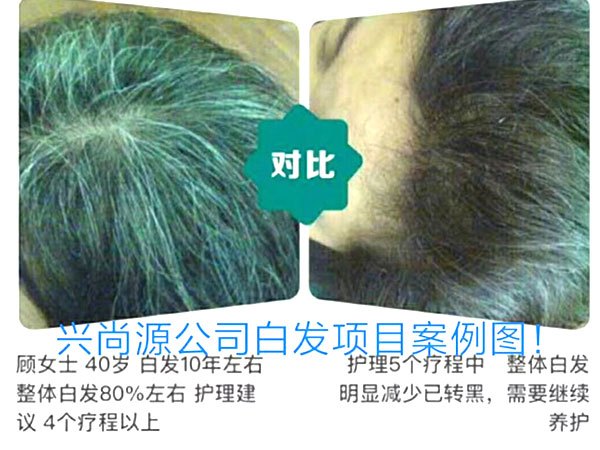 白发转黑发