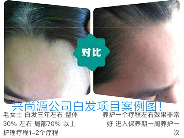 白发转黑发