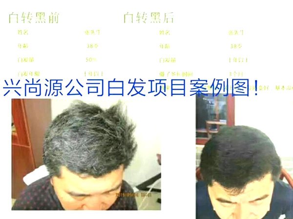 兴尚源头发白转黑