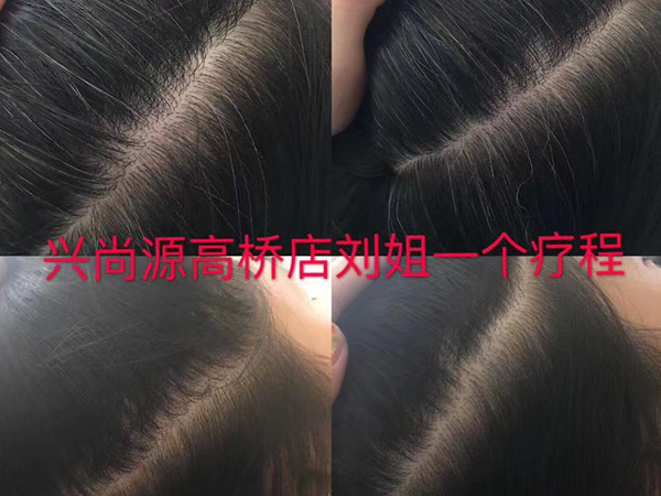 兴尚源白转黑