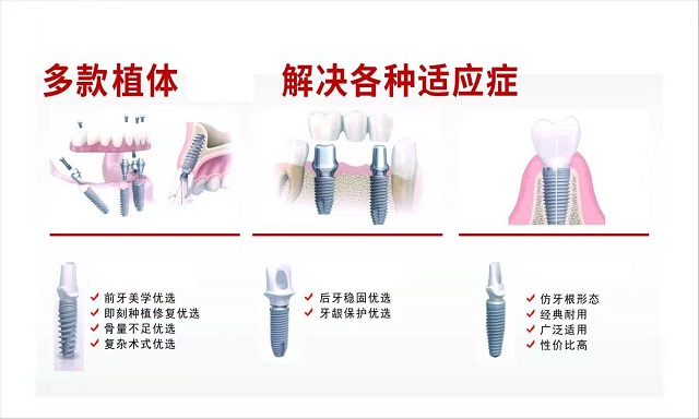 牙齿种植 (2)