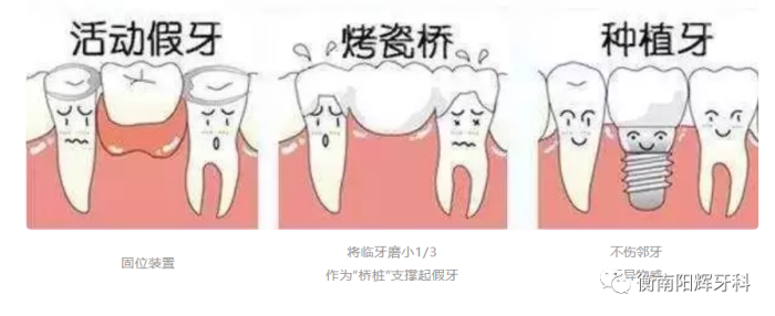 图片 4