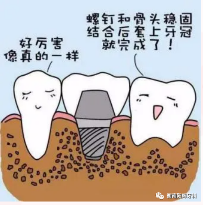 图片 3