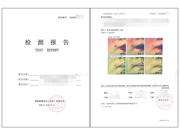 祛痘功效