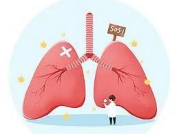 肺康复治疗—慢性阻塞性疾病患者的最佳选择