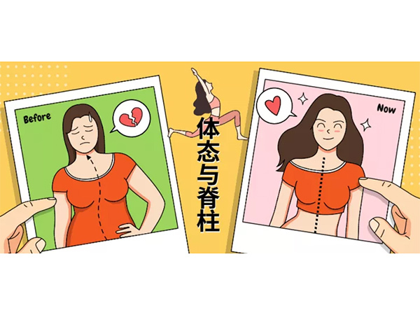 脊柱侧弯“青睐”女性，高瘦女孩很危险