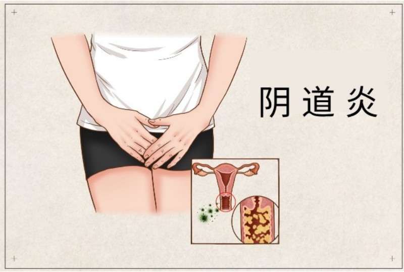 图片 2