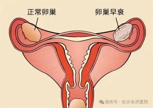 图片 1