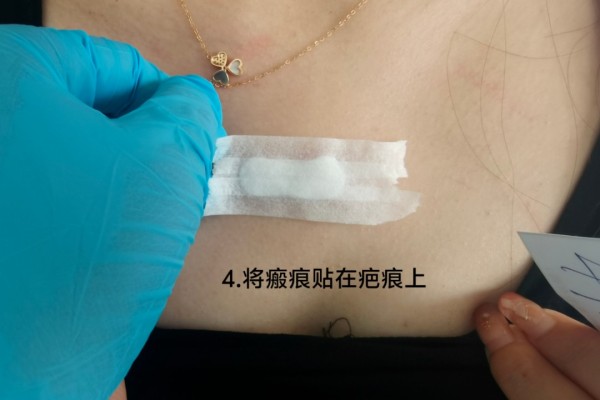 图片 8
