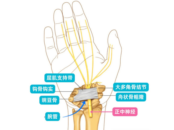 频繁半夜手麻惊醒？别再当成睡觉压到了！有可能是这种病找上门！
