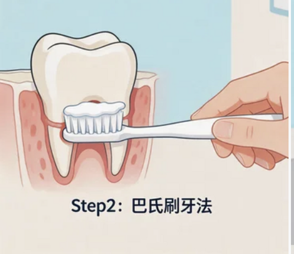 定期涂氟与洁牙：成年人也需要