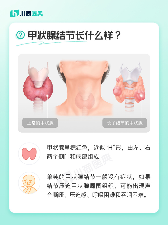 甲状腺1