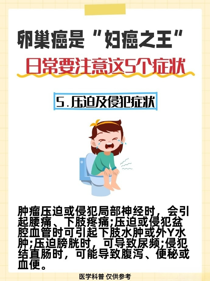 卵巢癌5