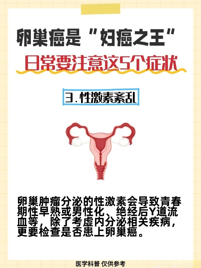 卵巢癌3