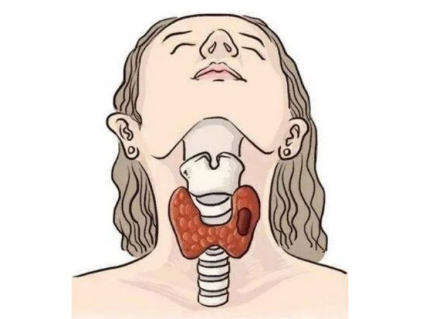 体检查出甲状腺结节别恐慌！岳阳广济医院带你科学读懂、规范防治！